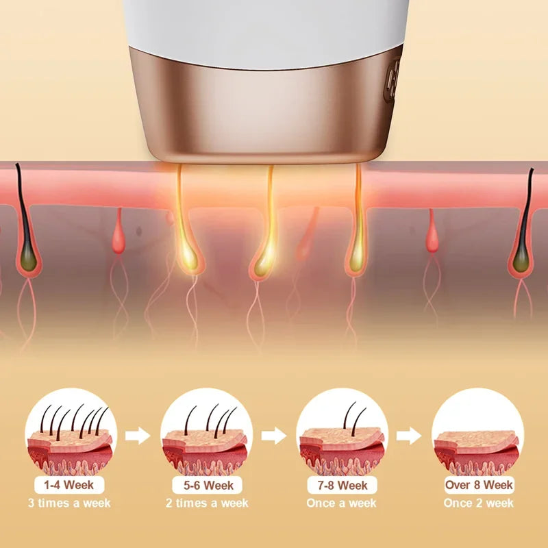 Pulsed light hair remover