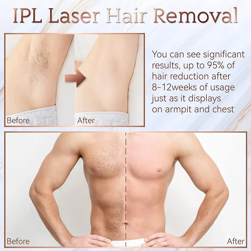 Pulsed light hair remover