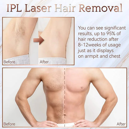Pulsed light hair remover